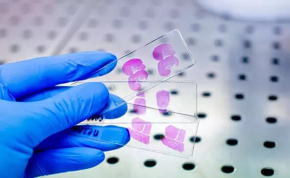 Pathology Testing